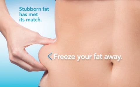 Hips treatment Norfolk From Lipo Sculpt