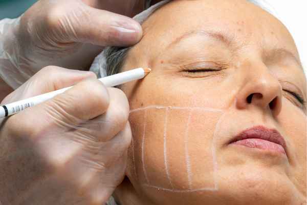 CryoPen: 5 Skin Concerns It May Be Used to Treat 4 What should you ask before having CryoPen treatment Norfolk?