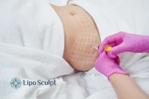 Are The Results From Aqualyx Permanent? 1 Do you want to know how long Aqualyx Norfolk results last?