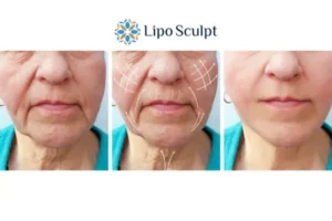 Explaining Total Skin Tightening Treatment And What It Can Do For You 3 Boost your confidence with Morpheus8 Norfolk call our team today!