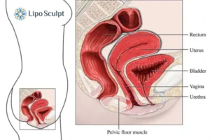 Treatment For A Leaky Bladder 2 How EM Chair treatment Norfolk can help Leaky bladder issues. Read more now!
