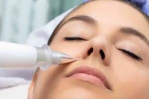 Best Actinic Keratoses Removal 3 Actinic keratoses Norfolk solutions - book in today!
