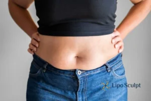 Bidding Farewell to Muffin Tops with Aqualyx Fat Injections 2 Do you wish you could reduce your muffin top Norfolk With Aqualy fat dissolving injections you can!